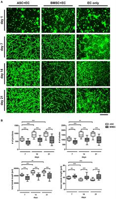 Microvascular Networks From Endothelial Cells and Mesenchymal Stromal Cells From Adipose Tissue and Bone Marrow: A Comparison